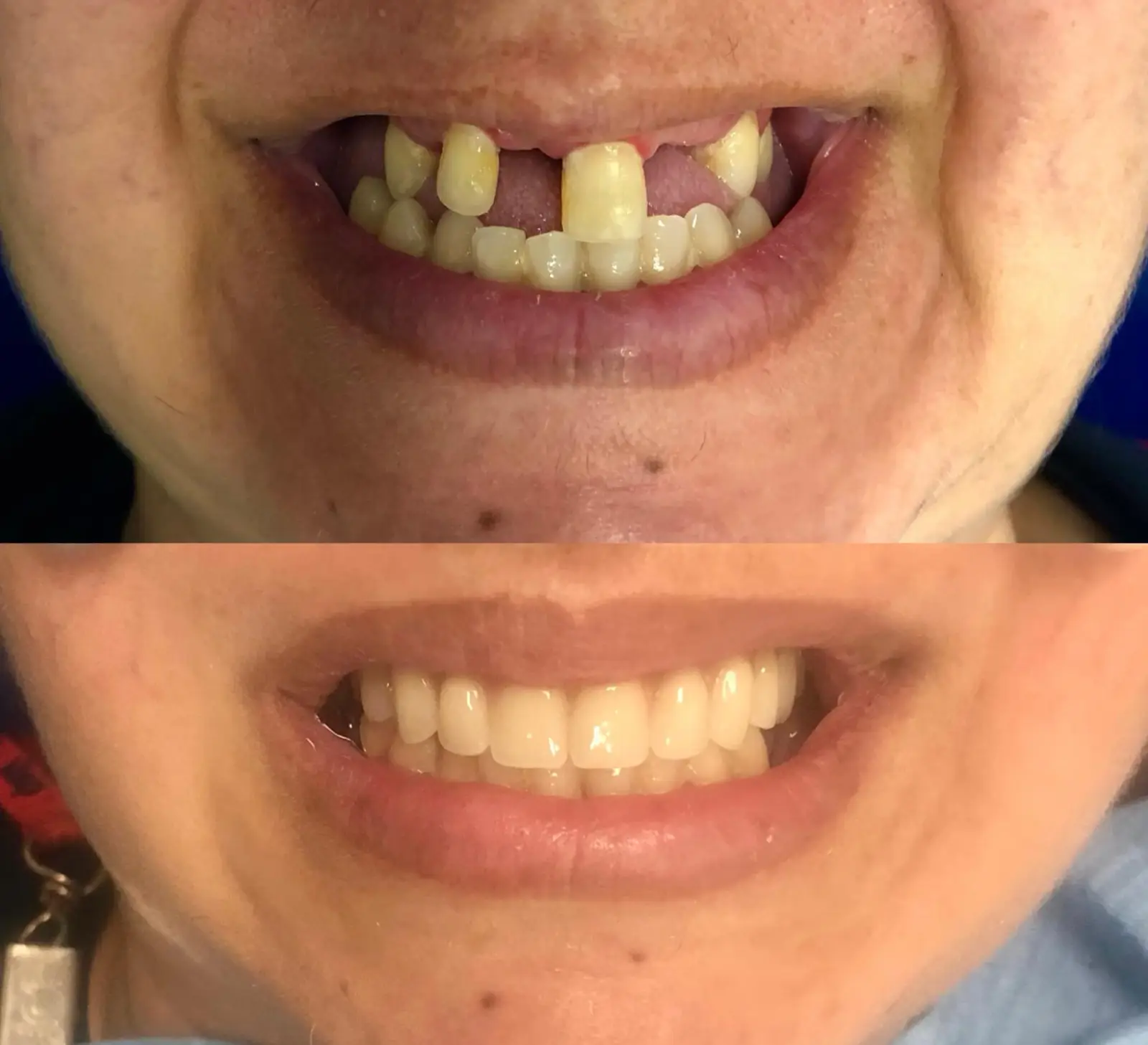 Antes e Depois - 5 (5)