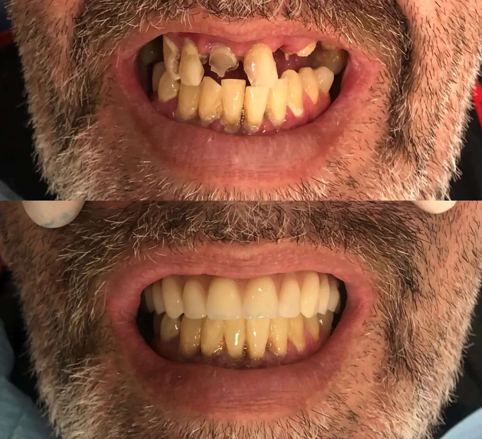 Antes e Depois - 5 (7)