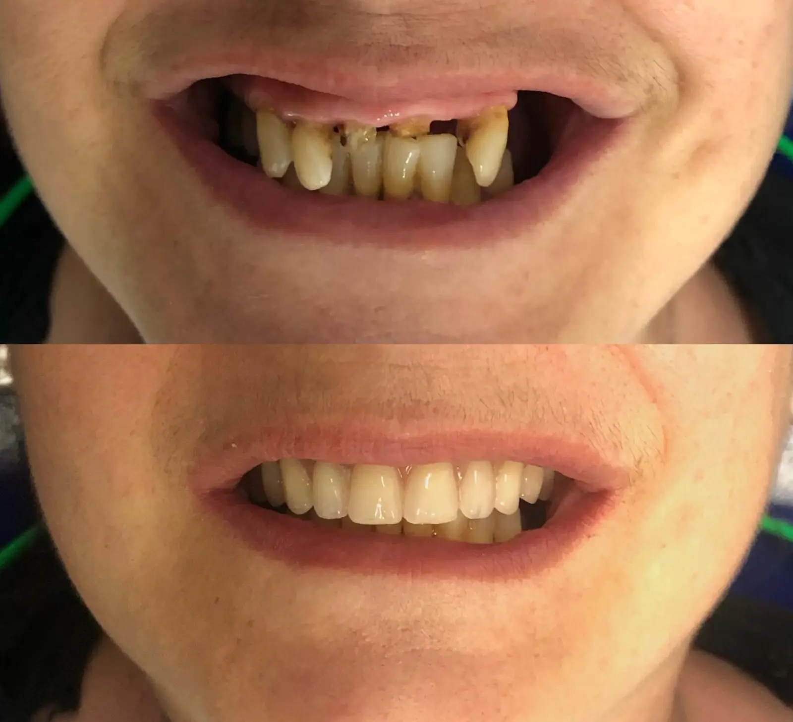 Antes e Depois - 5 (9)