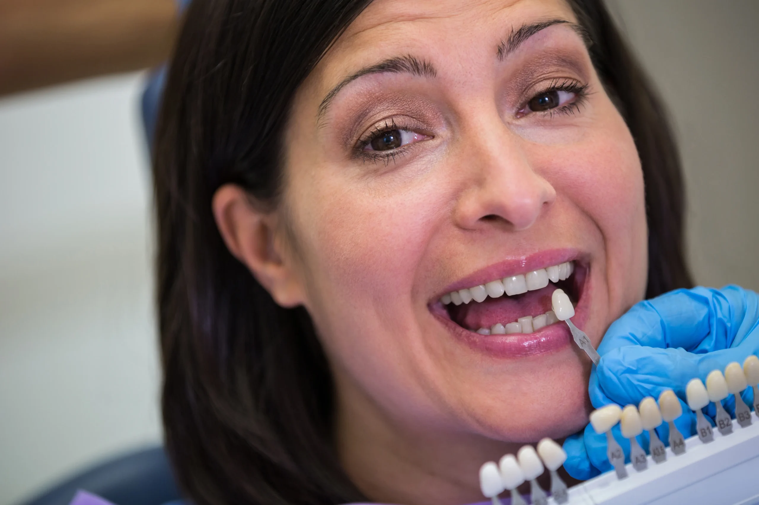 young-man-with-toothy-smile-demonstrating-his-dental-implant (3)