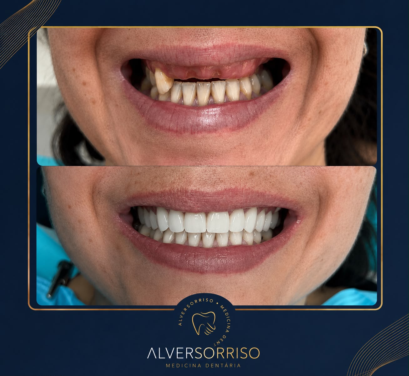 antes e depois 1