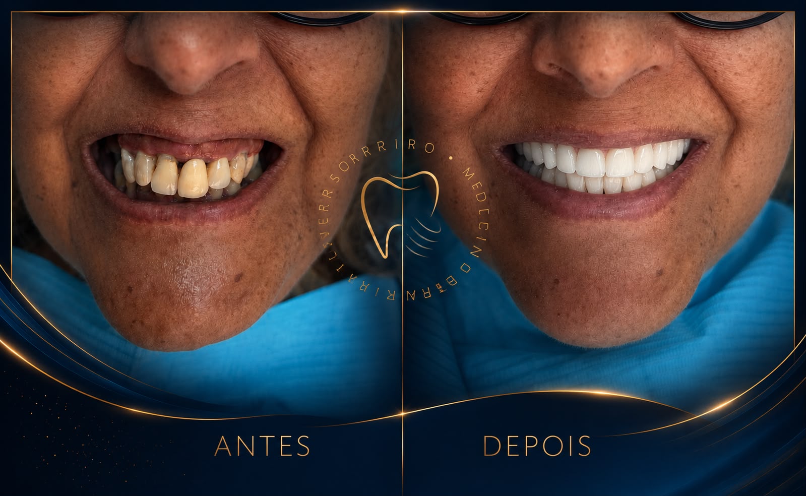 antes e depois 2